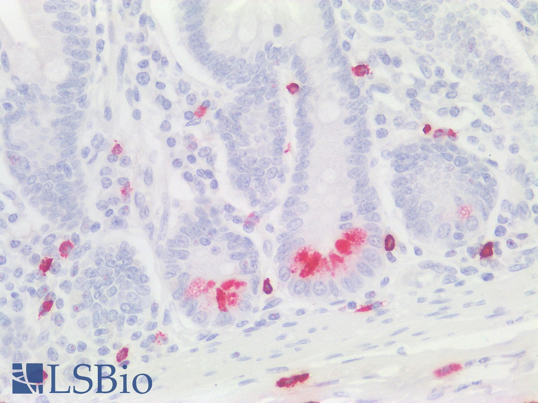 IHC-plus™ Polyclonal Rabbit anti-Human PRSS1 / Trypsin Antibody (IHC, IF, WB)