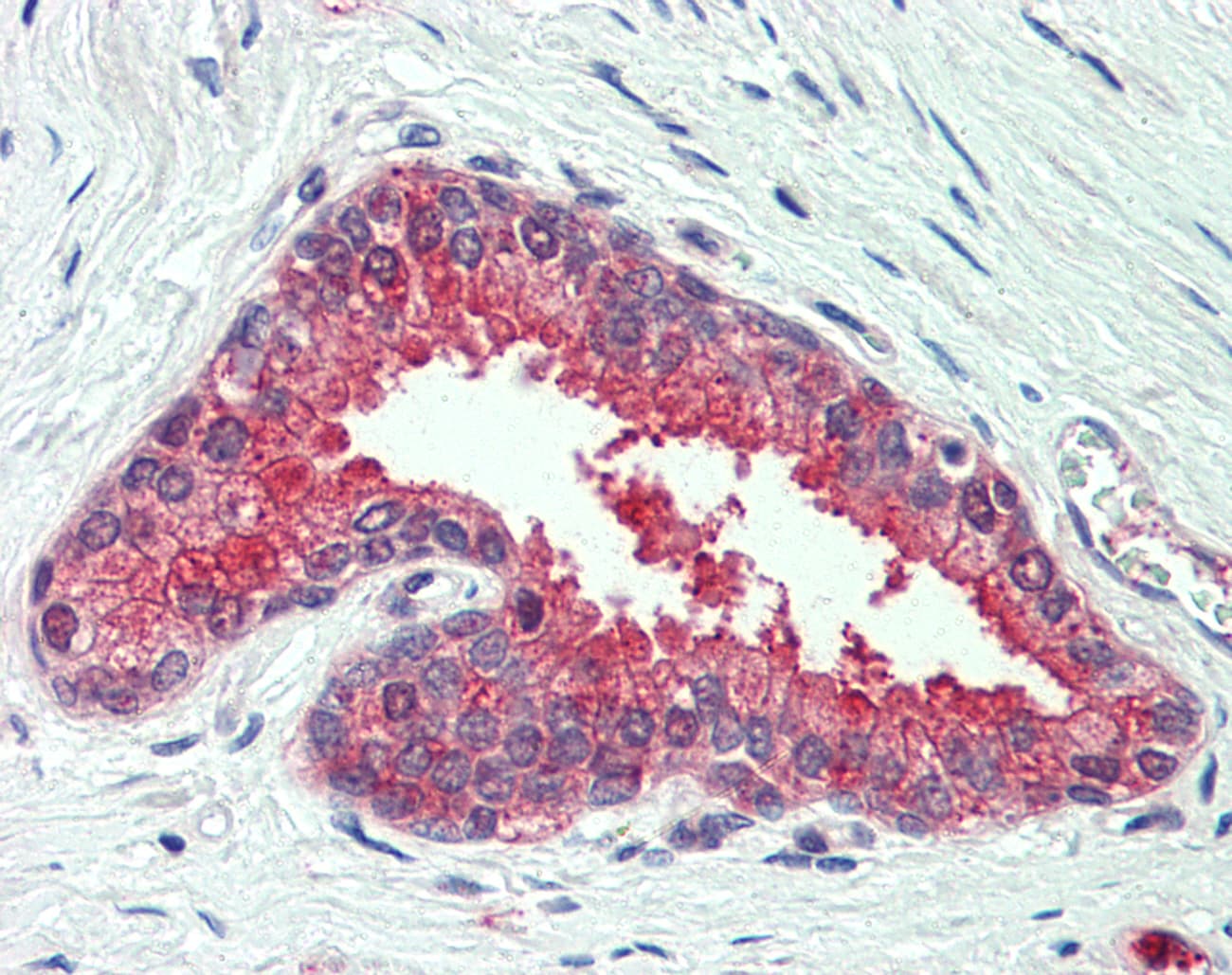 IHC-plus™ SLC12A2 / NKCC1 Antibody (N-Terminus)