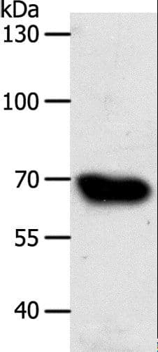 ABCG1 Antibody