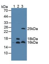 CST3 / Cystatin C Antibody (aa21-140)