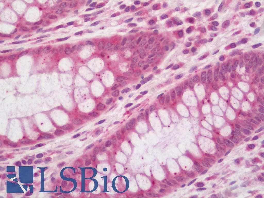 PTEN Antibody