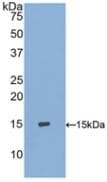 S100A9 / MRP14 Antibody (aa1-114, Biotin)