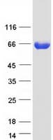 Human ACSS3 Protein (Recombinant Myc-DDK (Flag))