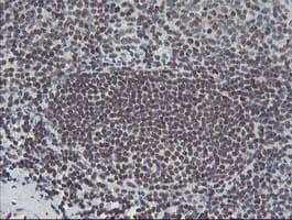 Monoclonal Mouse anti-Human TPRKB Antibody (clone OTI1E9, IHC, WB)
