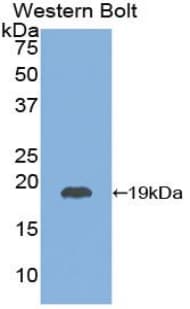 TSHB / TSH-Beta Antibody (aa20-134, FITC)
