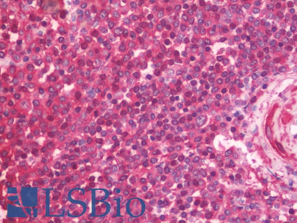 IHC-plus™ Monoclonal Mouse anti-Human DNAJA4 Antibody (clone 4B4-1F2, IHC, IF, WB)