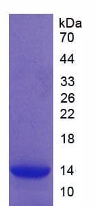 Mouse CFB / Complement Factor B Protein (Recombinant His)