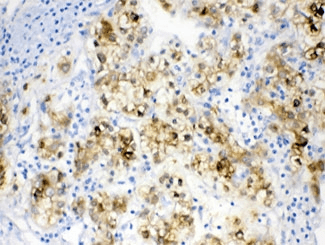 ADH1A / Alcohol Dehydrogenase Antibody