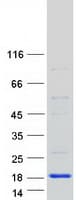 Human HSPC176 / TRAPPC2L Protein (Recombinant Myc-DDK (Flag))