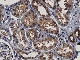 ACAT2 Antibody (clone OTI7B1)