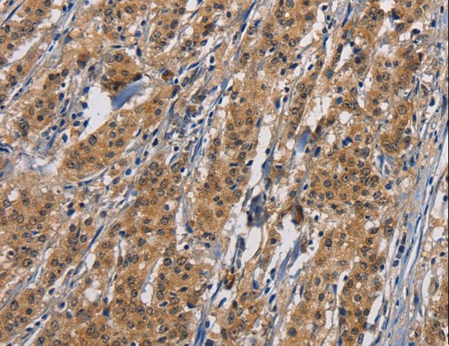PIKFYVE / PIP5K Antibody
