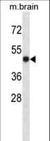 Polyclonal Rabbit anti-Human LTBR Antibody (aa29-57, WB)
