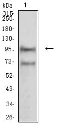 NCAM / CD56 Antibody (clone 1F6F10)
