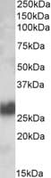 IHC-plus™ THY1 / CD90 Antibody (aa70-84)