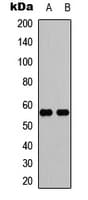 Polyclonal Rabbit anti-Human IFIT5 Antibody (Internal, WB)