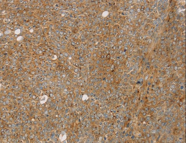 STX16 / Syntaxin 16 Antibody