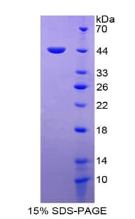 Human MIF Protein (Recombinant His-GST)