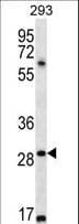 Polyclonal Rabbit anti-Human MESP1 Antibody (aa46-75, IHC, WB)