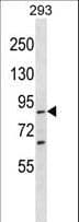 Polyclonal Rabbit anti-Human SPG20 / SPARTIN Antibody (aa491-519, WB)