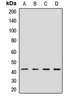 Polyclonal Rabbit anti-Human GPN1 / XAB1 Antibody (WB)