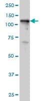 Monoclonal Mouse anti-Human TYK2 Antibody (clone 5A4, IF, WB)