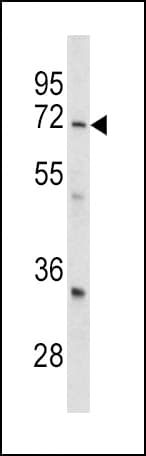 Polyclonal Rabbit anti-Human LRRC32 Antibody (aa234-260, IHC, WB)