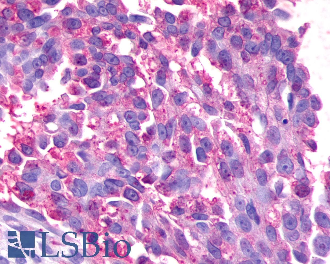 PathPlus™ GPR17 Antibody (Cytoplasmic Domain)