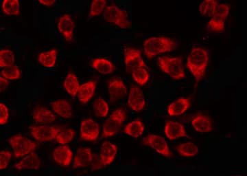 NME2 Antibody