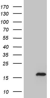 MLC3F / MYL1 Antibody (aa2-150, clone OTI2E11)