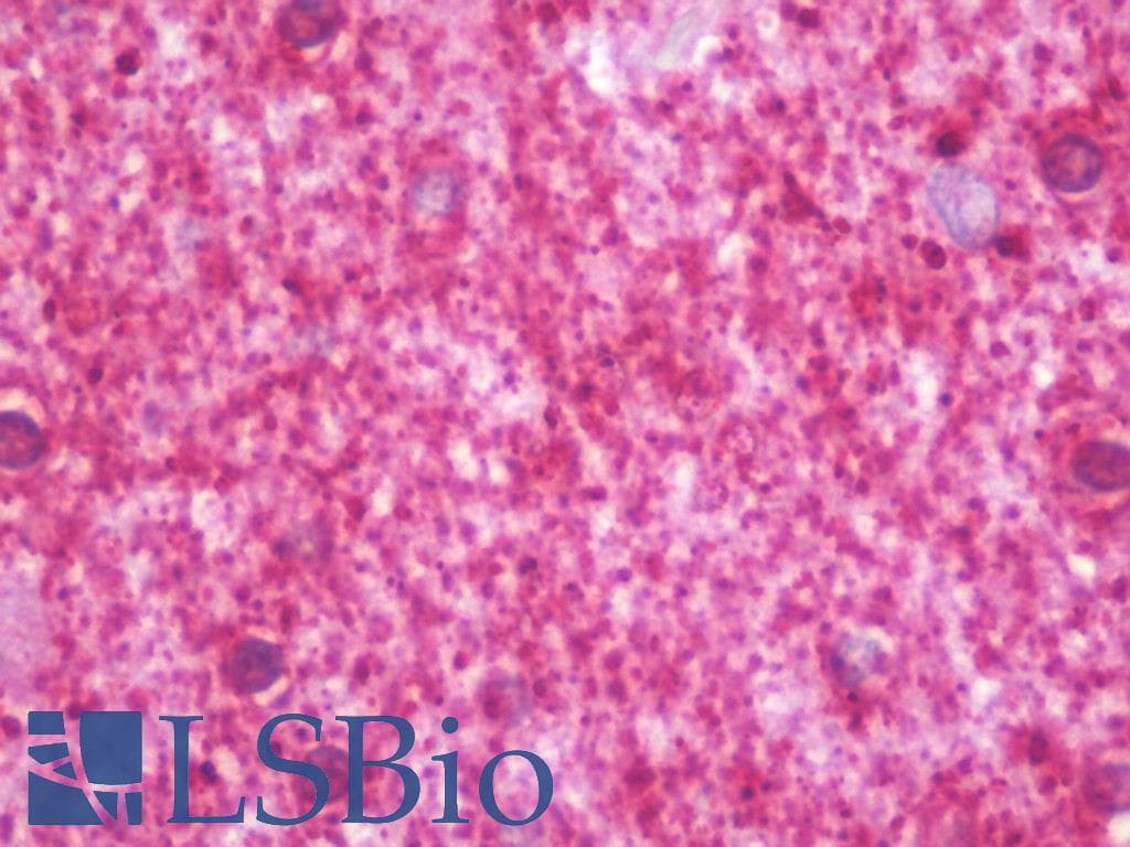 IHC-plus™ Polyclonal Rabbit anti-Human PPFIA3 Antibody (IHC, WB)