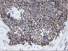 REEP2 Antibody (clone OTI2C7)