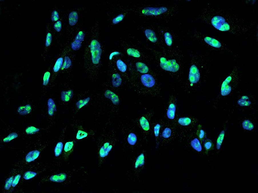 Polyclonal Rabbit anti-Human DDX21 Antibody (IF, WB)