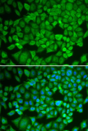 NR0B1 / DAX1 Antibody