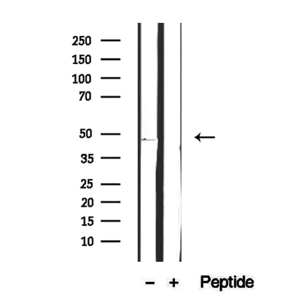 FBXO22 Antibody