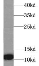 Polyclonal Rabbit anti-Human IL8 / Interleukin 8 Antibody (IHC, WB)