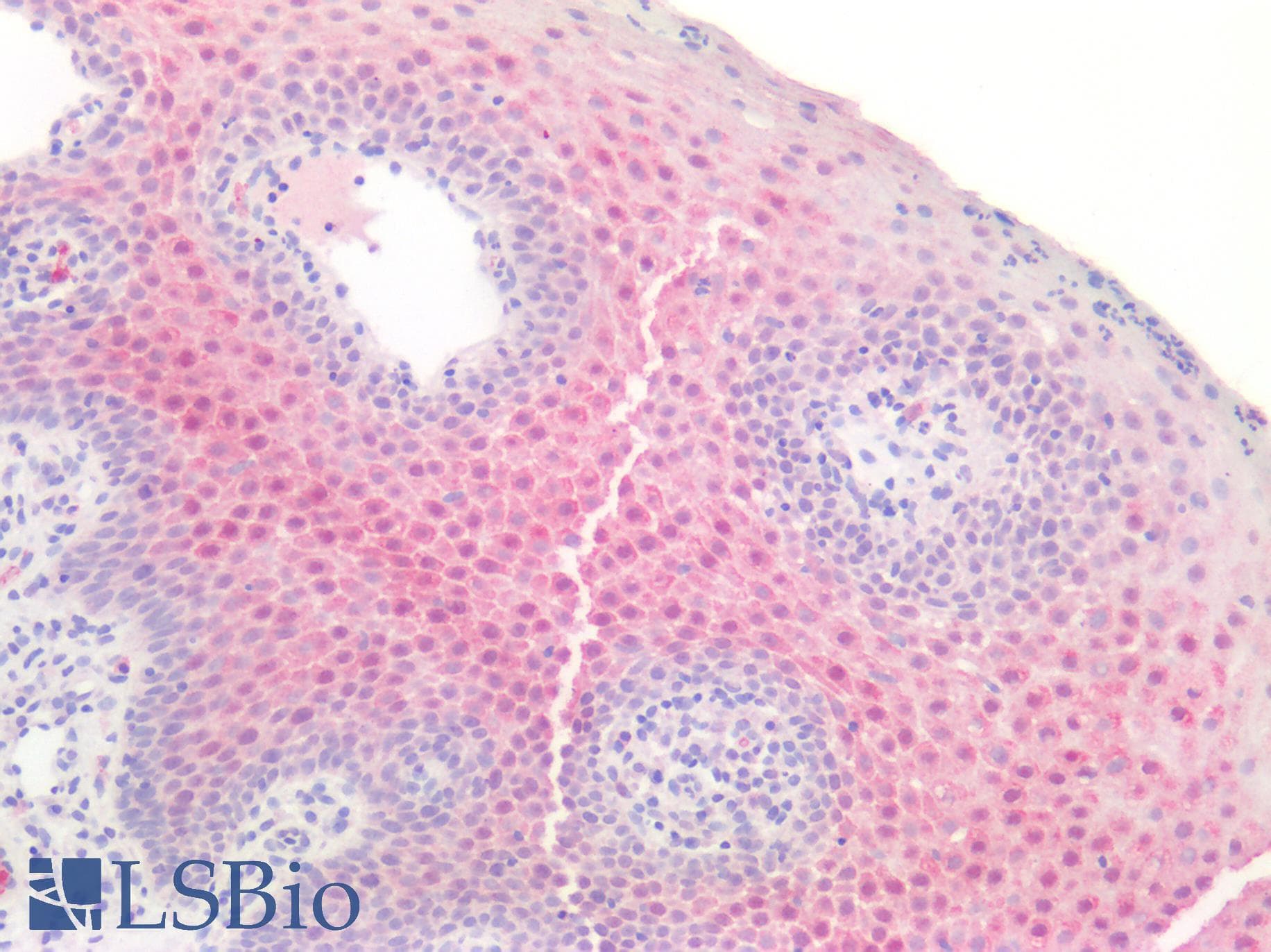 IHC-plus™ CALML3 Antibody