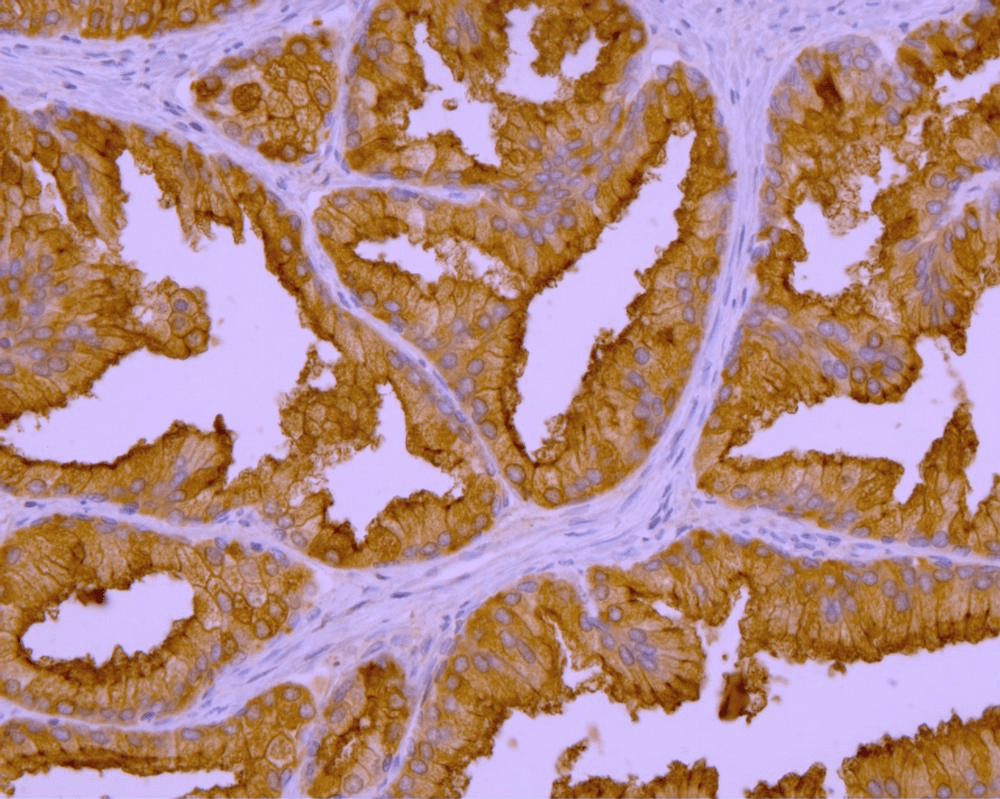 FOLH1 / PSMA Antibody (clone GCP-04)