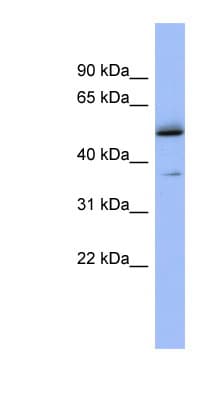 Polyclonal Rabbit anti-Human AKAP7 Antibody (aa129-178, WB)