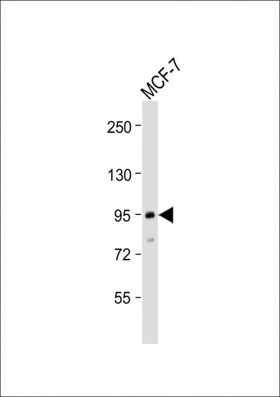 Betaglycan / TGFBR3 Antibody (N-Terminus)