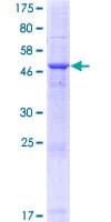 Human PLAC1 Protein (Recombinant GST)