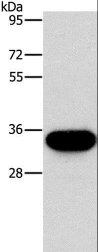 HOXB13 Antibody