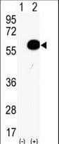 AKT2 Antibody (aa93-123)