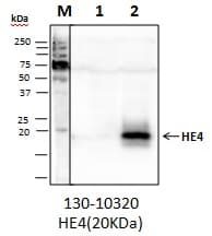 WFDC2 / HE4 Antibody (clone 2E4-H9-H5, Preservative Free)