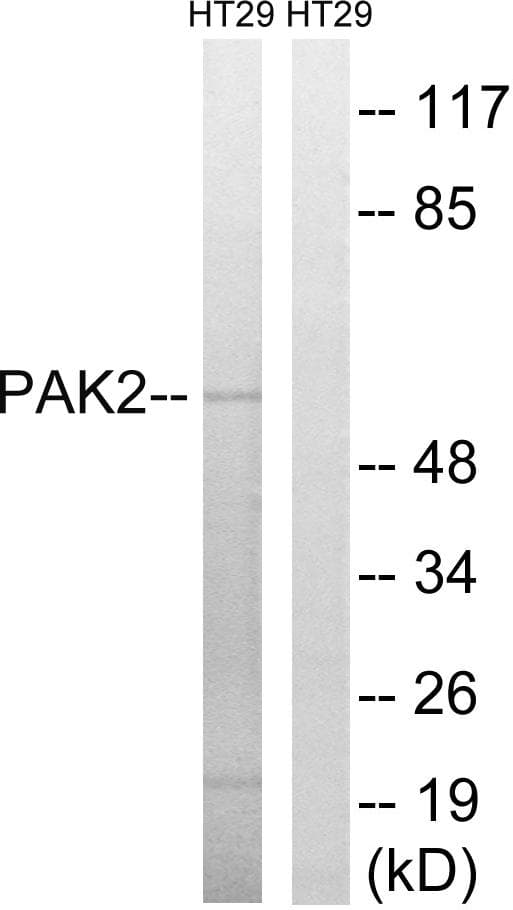Polyclonal Rabbit anti-Human PAK2 Antibody (p197, WB)