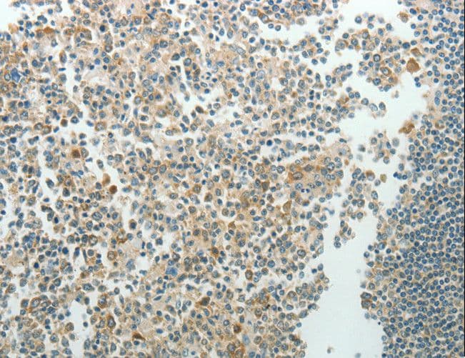 NDRG3 Antibody