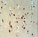 TNRC9 / TOX3 Antibody (aa214-242)