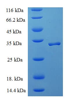 Human SRP19 Protein (Recombinant His-SUMO)