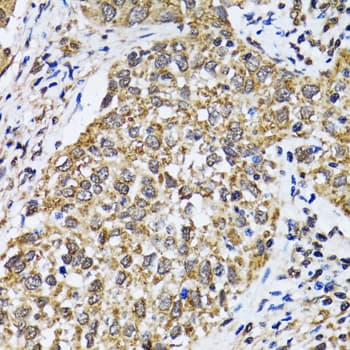 TP53 / p53 Antibody