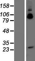 APP / Beta Amyloid Precursor Protein (Over-Expression Lysate Myc-DDK (Flag))