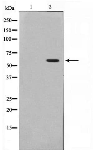MAPKAPK5 / PRAK Antibody (phospho-Thr182)